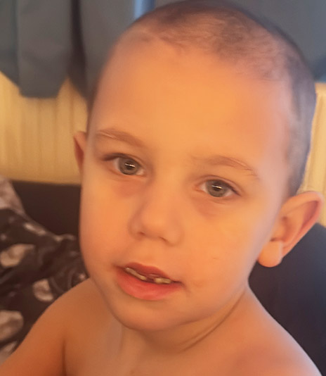 Projekt PECS Therapie