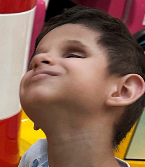 Projekt Cuevas Medek Therapie